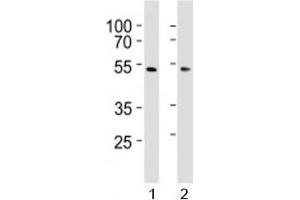 Western blot analysis of lysate from 1) HepG2 and 2) HUVEC cell line using SUV39H2 antibody at 1:1000. (SUV39H2 antibody  (AA 93-122))