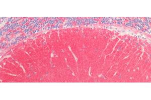 Detection of SYT1 in Human Cerebellum Tissue using Polyclonal Antibody to Synaptotagmin I (SYT1) (SYT1 antibody  (AA 136-422))