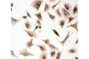 Immunocytochemistry (ICC) image for anti-Caveolin 1, Caveolae Protein, 22kDa (CAV1) (AA 4-178) antibody (ABIN3030338)
