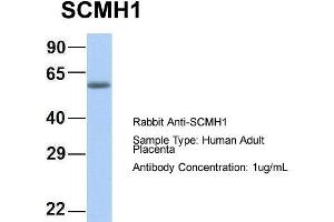 Host: Rabbit Target Name: CHAD Sample Type: Human Adult Placenta Antibody Dilution: 1. (SCMH1 antibody  (Middle Region))