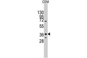 Western blot analysis of PITX2 polyclonal antibody  in CEM cell line lysates (35 ug/lane). (PITX2 antibody  (C-Term))