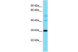 Host:  Rabbit  Target Name:  RNF149  Sample Type:  Lung Tumor lysates  Antibody Dilution:  1. (RNF149 antibody  (C-Term))