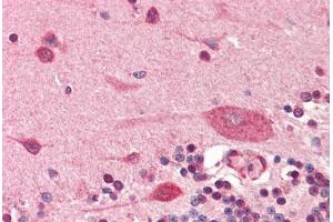 Human Brain, Cerebellum (formalin-fixed, paraffin-embedded) stained with PDPN antibody ABIN364350 at 5 ug/ml followed by biotinylated anti-mouse IgG secondary antibody ABIN481714, alkaline phosphatase-streptavidin and chromogen. (Podoplanin antibody  (AA 1-206))