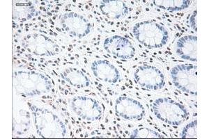 Image no. 2 for anti-Glial Fibrillary Acidic Protein (GFAP) antibody (ABIN1498436) (GFAP antibody)