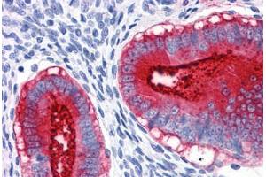 Immunohistochemistry (Formalin-fixed Paraffin-embedded Sections) (IHC (fp)) image for anti-Mucin 1 (MUC1) antibody (ABIN574167)