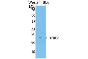 Detection of Recombinant ACP, Human using Polyclonal Antibody to Acyl Carrier Protein, Mitochondrial (ACP) (NDUFAB1 antibody  (AA 5-129))