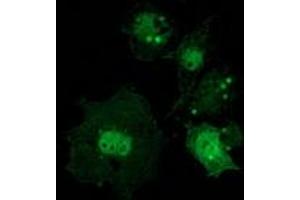 Anti-CTNNB1 mouse monoclonal antibody (ABIN2454167) immunofluorescent staining of COS7 cells transiently transfected by pCMV6-ENTRY CTNNB1 (RC208947).