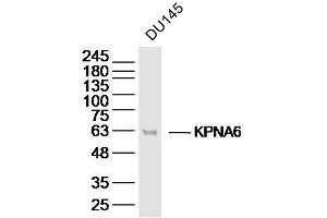 DU145 lysates probed with KPNA6 Polyclonal Antibody, Unconjugated  at 1:300 dilution and 4˚C overnight incubation. (KPNA6 antibody  (AA 101-200))