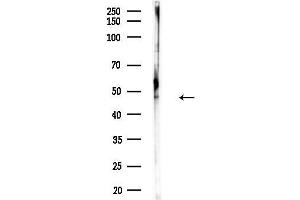 Western blot analysis of lysates from COLO205 cells(heat-shock,45 min treatment), using TXNDC5 Antibody at 1/1000 dilution.