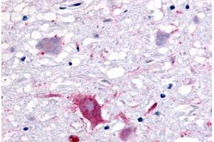 Anti-GPR32 antibody  ABIN1048800 IHC staining of human brain, neurons and glia. (GPR32 antibody  (Extracellular Domain))