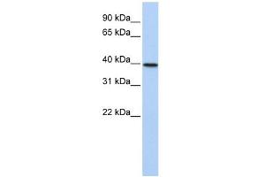TIA1 antibody used at 1 ug/ml to detect target protein. (TIA1 antibody  (N-Term))