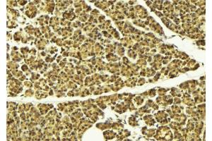 ABIN6274105 at 1/100 staining Mouse pancreas tissue by IHC-P. (AKAP8 antibody  (Internal Region))