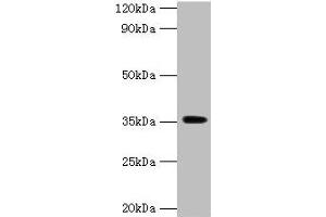 Western blot All lanes: DOK5 antibody at 2 μg/mL + Mouse kidney tissue Secondary Goat polyclonal to rabbit IgG at 1/15000 dilution Predicted band size: 36, 23 kDa Observed band size: 36 kDa (DOK5 antibody  (AA 1-198))