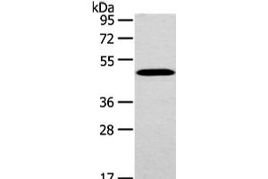 Western Blot analysis of Mouse brain tissue using WWOX Polyclonal Antibody at dilution of 1/200 (WWOX antibody)