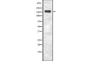 Western blot analysis of EEA1 using Jurkat whole cell lysates (EEA1 antibody  (Internal Region))