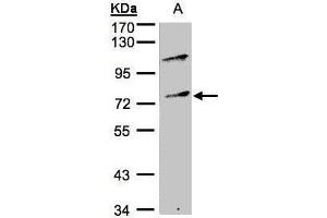WB Image Sample(30 ug whole cell lysate) A:Raji , 10% SDS PAGE antibody diluted at 1:500 (MZF1 antibody)