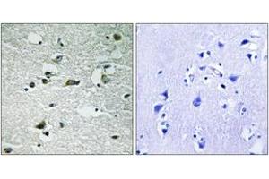 Immunohistochemistry analysis of paraffin-embedded human brain, using CK-1 gamma1/2/3 (Phospho-Tyr263) Antibody. (CK-1 gamma1/2/3 (AA 229-278), (pTyr263) antibody)