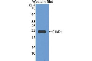 Western Blotting (WB) image for anti-Carbonic Anhydrase VA (CA5A) (AA 7-179) antibody (ABIN1175974) (CA5A antibody  (AA 7-179))