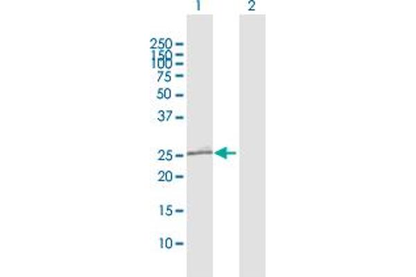 OIP5 antibody  (AA 1-229)