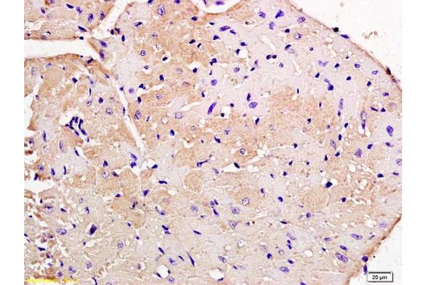 Nebulette antibody  (AA 360-403)