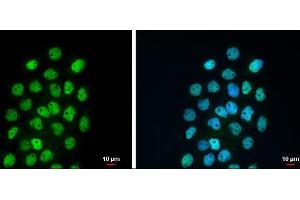 ICC/IF Image p63 antibody [N2C1], Internal detects p63 protein at nucleus by immunofluorescent analysis.