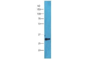 TXNDC9 anticorps  (AA 182-226)