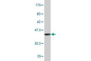 Western Blot detection against Immunogen (37. (ALX1 antibody  (AA 198-306))