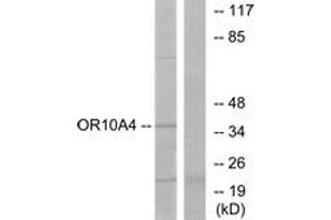 Western blot analysis of extracts from COLO cells, using OR10A4 Antibody. (OR10A4 antibody  (AA 261-310))