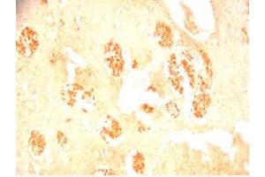 Rat brain tissue was stained by Rabbit Anti-Metasin (1-25) / KISS-1 (68-92) (Human) Serum (KISS1 antibody  (AA 1-25, AA 68-92))