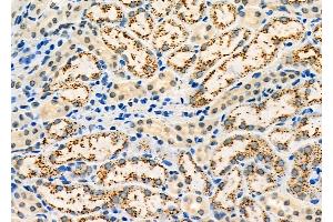 ABIN6260842 and ABIN6273209 at 1/100 staining Mouse kidney tissue by IHC-P.