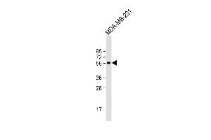 Anti-D Antibody (N-term) at 1:1000 dilution + MDA-MB-231 whole cell lysate Lysates/proteins at 20 μg per lane. (DMP1 antibody  (N-Term))