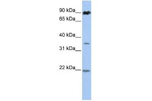 WB Suggested Anti-C13orf7  Antibody Titration: 0. (RNF219 antibody  (N-Term))
