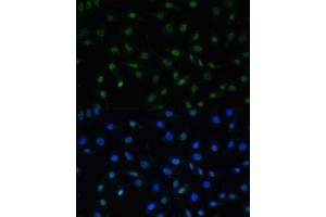 Immunofluorescence analysis of L929 cells using HSF1 antibody (ABIN6131141, ABIN6142021, ABIN6142022 and ABIN6217875) at dilution of 1:100.