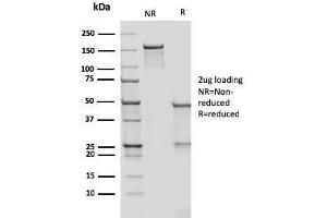 SDS-PAGE Analysis Purified CD209 Mouse Monoclonal Antibody (rC209/1781). (Recombinant DC-SIGN/CD209 antibody)