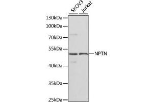 Western blot analysis of extracts of various cell lines, using NPTN antibody (ABIN6129584, ABIN6144789, ABIN6144790 and ABIN6223981) at 1:1000 dilution. (NPTN antibody  (AA 29-200))