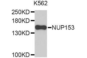 Western blot analysis of extracts of K-562 cells, using NUP153 antibody (ABIN5996414). (NUP153 antibody)