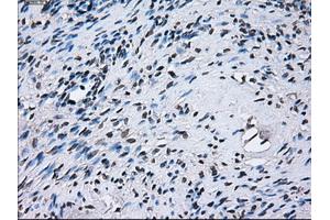 Immunohistochemical staining of paraffin-embedded colon tissue using anti-PSMA7mouse monoclonal antibody.