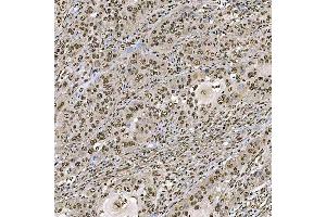 IHC analysis of SART1 using anti-SART1 antibody (ABIN7599884). (SART1 antibody  (AA 125-800))