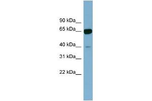 WB Suggested Anti-ZNF169 Antibody Titration:  0. (ZNF169 antibody  (N-Term))