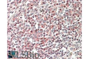 ABIN185254 (5µg/ml) staining of paraffin embedded Human Spleen. (CD2BP2 antibody  (N-Term))