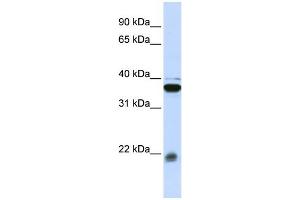 WB Suggested Anti-MYL9 Antibody Titration: 0. (MYL9 antibody  (Middle Region))