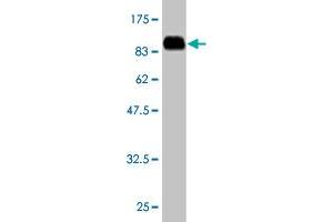 Western Blot detection against Immunogen (85. (ACD antibody  (AA 1-544))