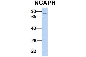 Host:  Rabbit  Target Name:  NCAPH  Sample Type:  Human Jurkat  Antibody Dilution:  1.