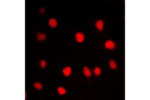 Immunofluorescent analysis of BRD3 staining in HepG2 cells. (BRD3 antibody  (C-Term))