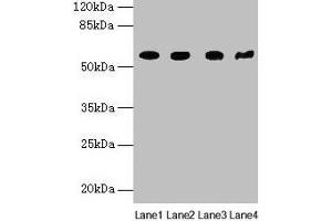 Western blot All lanes: KRT79 antibody at 1 μg/mL Lane 1: Mouse lung tissue Lane 2: A549 whole cell lysate Lane 3: 293T whole cell lysate Lane 4: Mouse gonadal tissue Secondary Goat polyclonal to rabbit IgG at 1/10000 dilution Predicted band size: 58 kDa Observed band size: 58 kDa (Cytokeratin 79 antibody  (AA 1-300))
