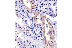 (ABIN6243380 and ABIN6577115) staining XI in human kidney sections by Immunohistochemistry (IHC-P - paraformaldehyde-fixed, paraffin-embedded sections). (XIAP antibody)
