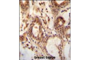 NUDT15 antibody immunohistochemistry analysis in formalin fixed and paraffin embedded human breast tissue followed by peroxidase conjugation of the secondary antibody and DAB staining. (NUDT15 antibody  (C-Term))