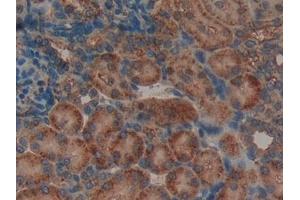 Immunohistochemistry (IHC) image for anti-Leukemia Inhibitory Factor Receptor alpha (LIFR) (AA 152-291) antibody (ABIN7432040)