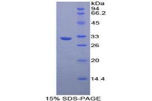 SDS-PAGE analysis of Human Nucleoporin 88 kDa Protein. (NUP88 Protein)