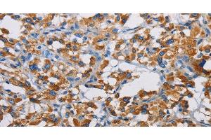 Immunohistochemistry (Paraffin-embedded Sections) (IHC (p)) image for anti-Thrombospondin-Type Laminin G Domain and EAR Repeats (TSPEAR) antibody (ABIN7240748)